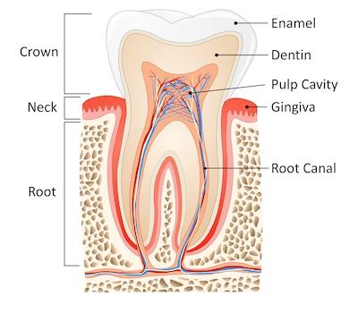 dental crowns wilmington de