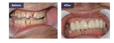 cosmetic dentistry work in wilmington de