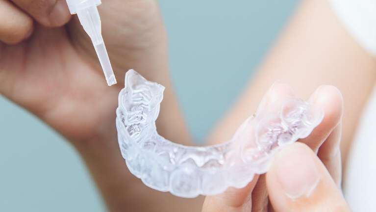 Teeth whitening gel being put on a mouth guard, wilmington tde